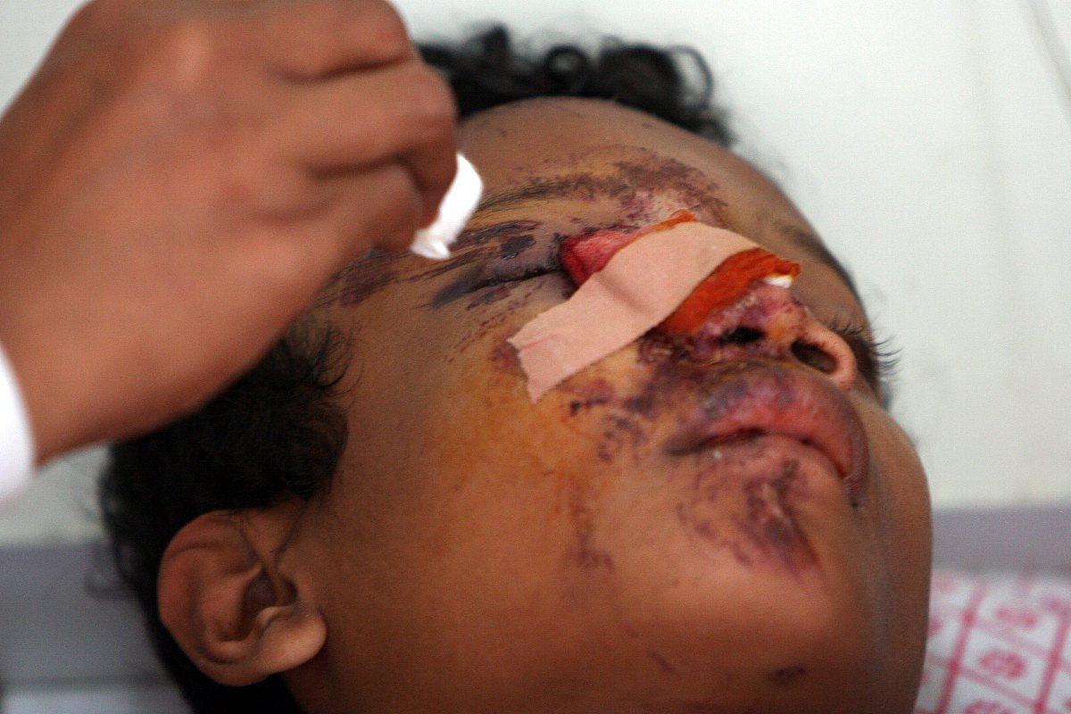 右额收到撞击半年后右额头皮有轻微疼痛感怎么处理