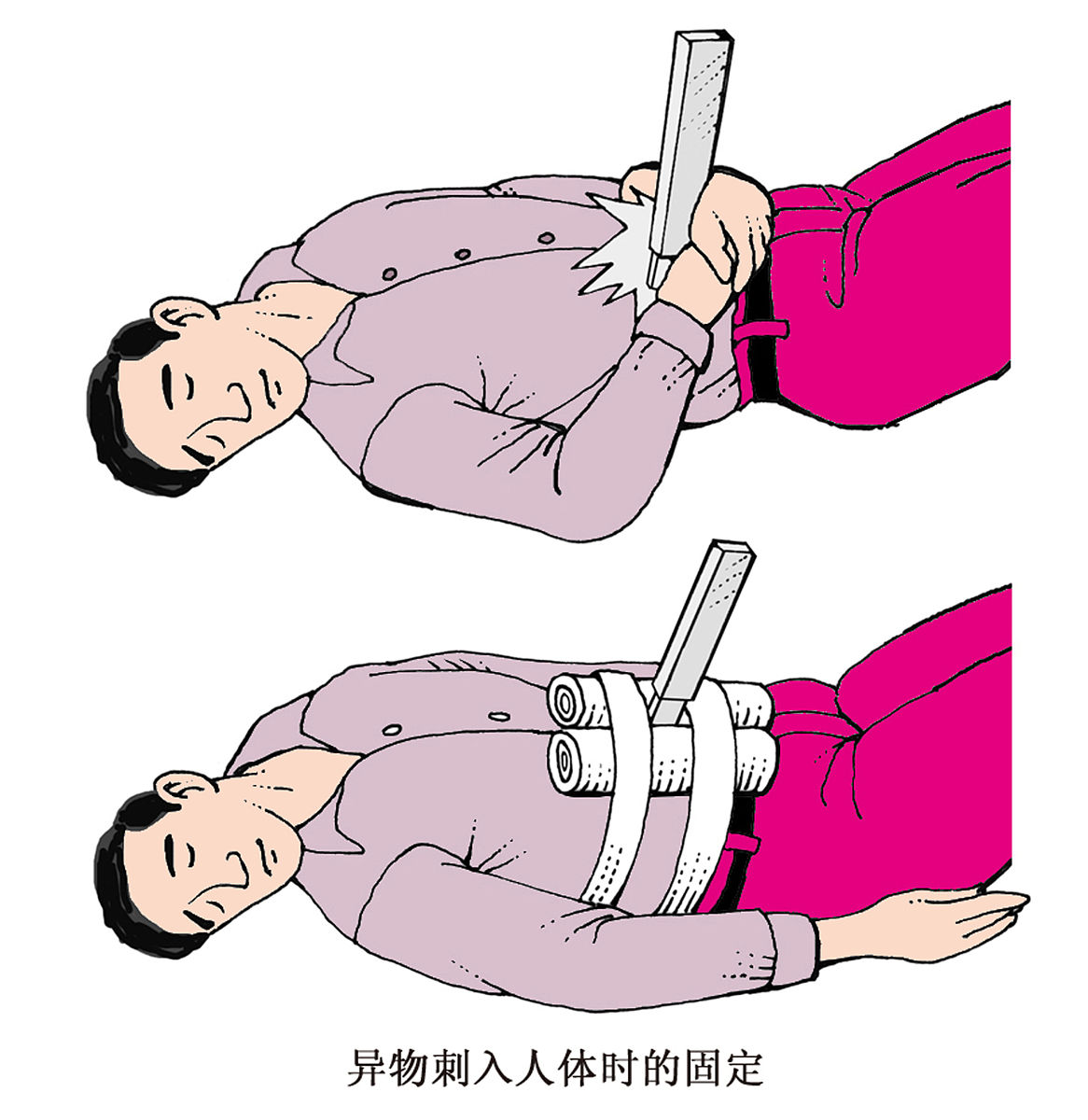 偏瘫患者平衡能力与肌肉协调关系：网络分析揭示新发现