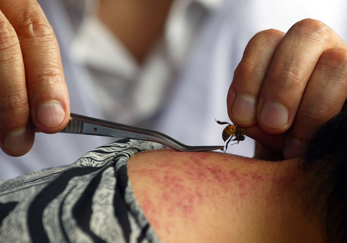 基于个体化治疗算法模型优化膝关节骨关节炎患者长期疗效的Meta分析