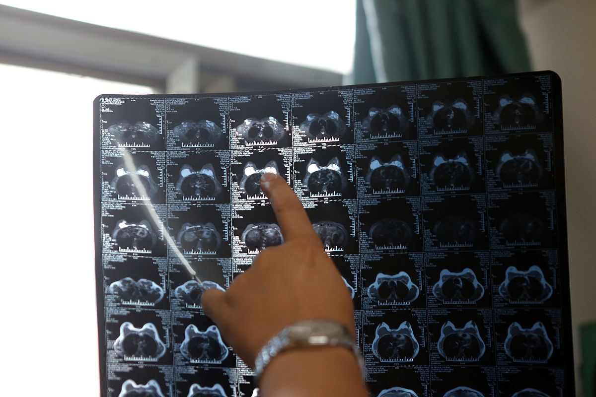 聚丙烯酰胺水凝胶的导热系数