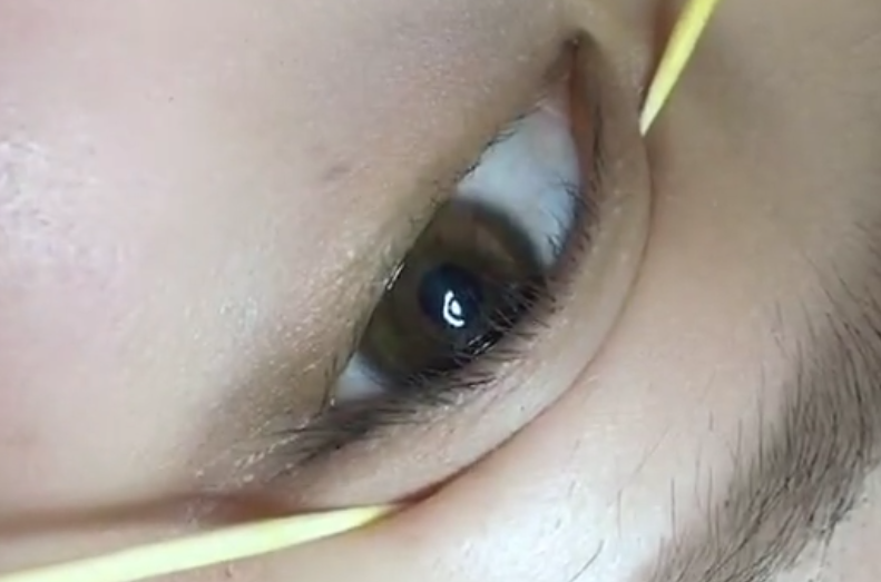 单眼皮肿泡眼的妹子快看,用牙签这样撑一会,双眼皮超明显!