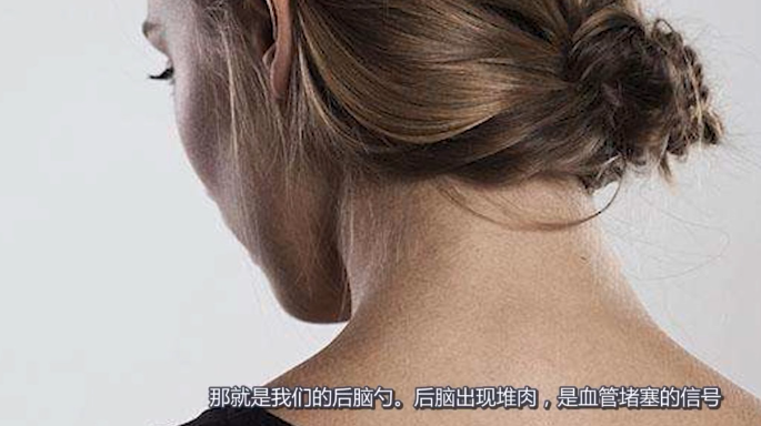 人体这个部位长肉,预示颈部血管堵了,拖久了可能会引起脑梗!