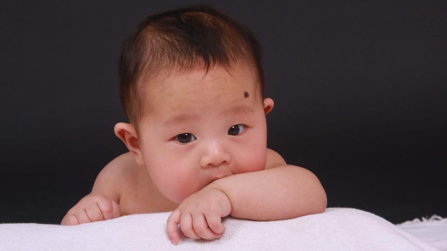 这四种胎记会给孩子造成很大的影响,宝妈们还没有重视起来么!
