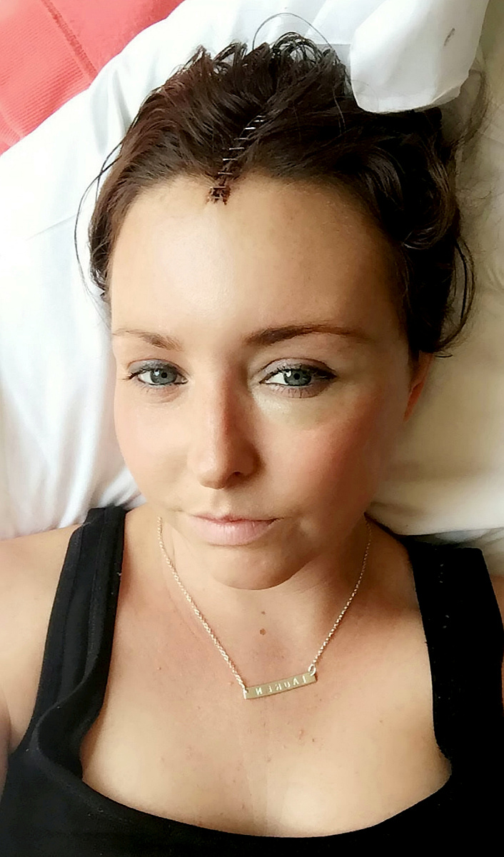 面部烧伤患者心理护理干预研究：现状与展望