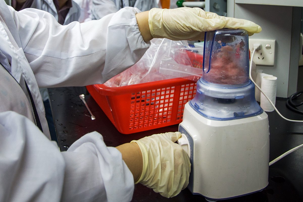 液体过量还是不足？找到最佳液体治疗平衡点
