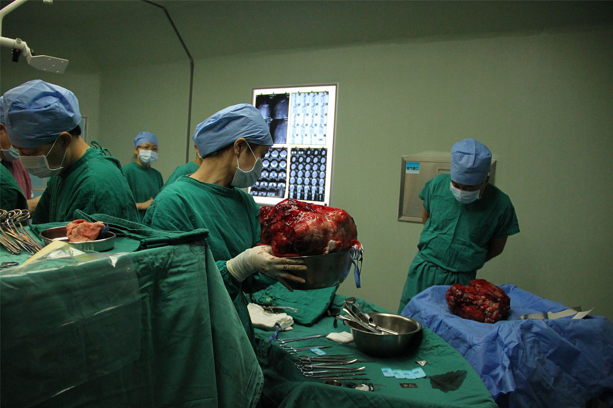 肝癌切除术后并发症预防指南：术后恢复的关键步骤