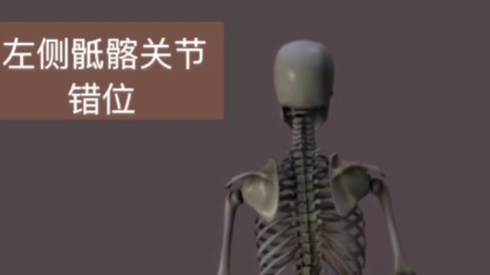 [图]「3D动画课堂」骶髂关节错位的原因与影响