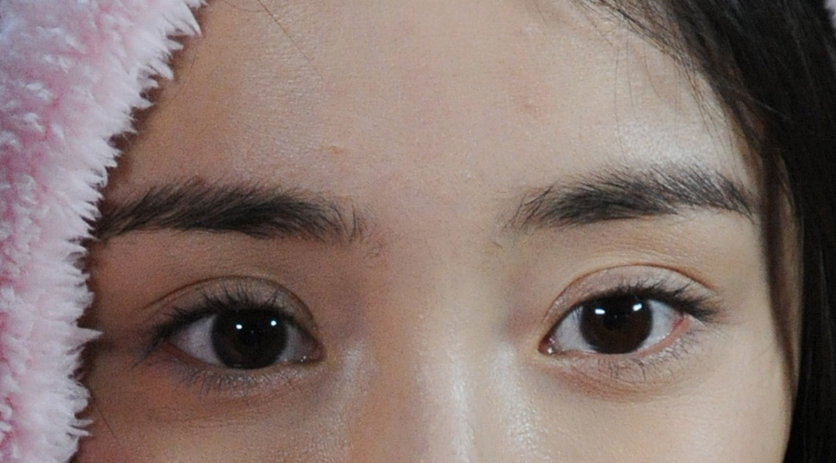 外眼角+下至术：打造迷人双眼，朋友圈爆款！