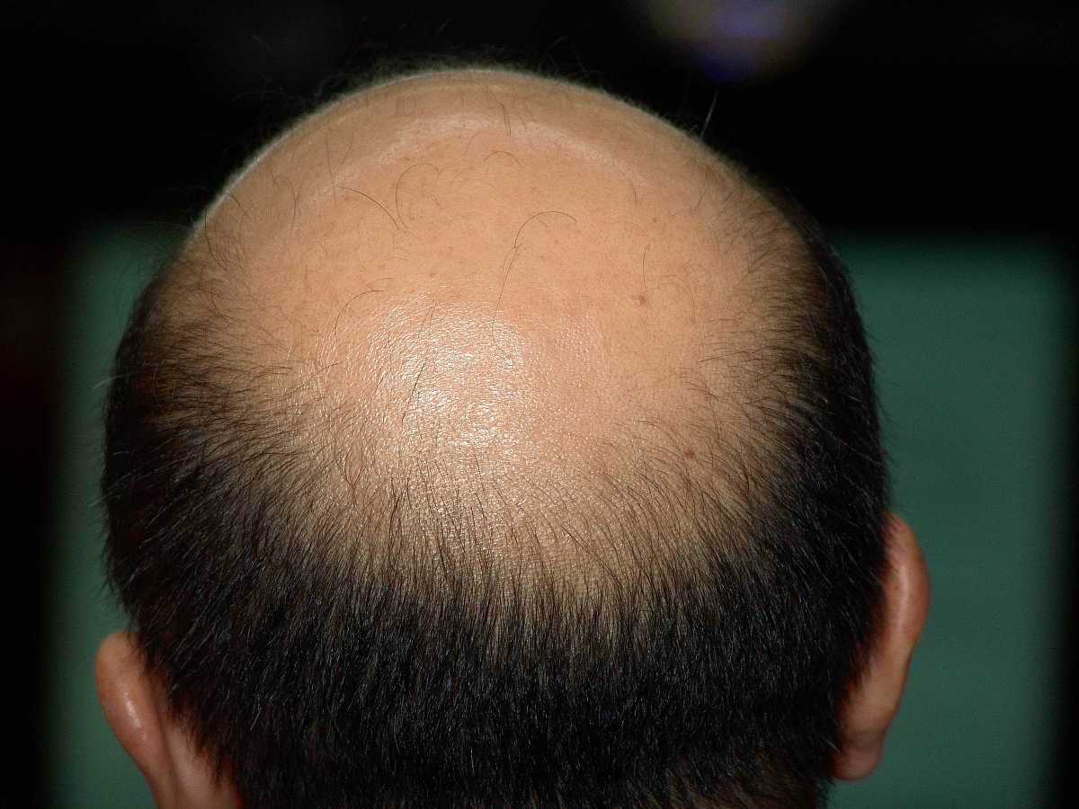 以卓越技术与优质服务引领植发行业正向发展仿写上述标题为小森林专科植发制定6个标题