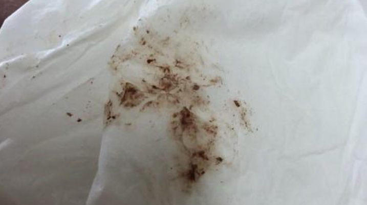男女有别,女生便后该怎么擦?牢记3点,别让细菌病毒趁虚而入!