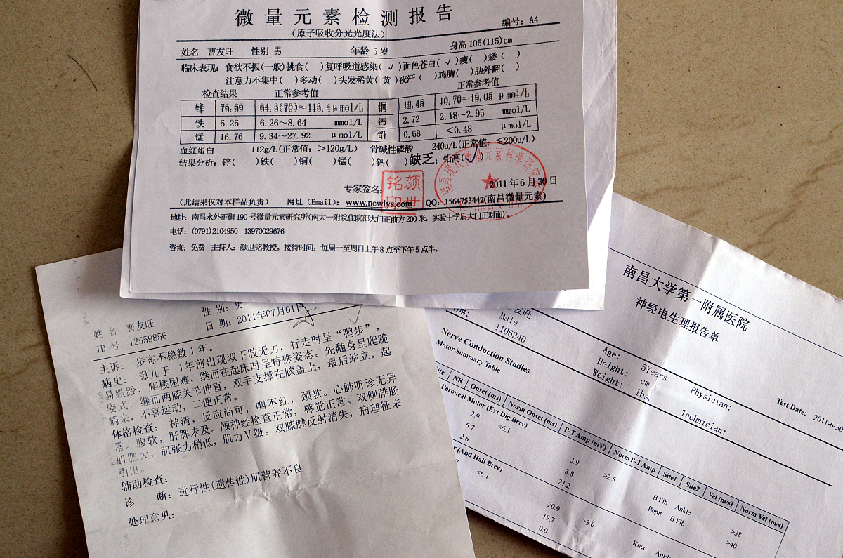重度摔伤致骨折及内账受损需要多少钱的治疗费
