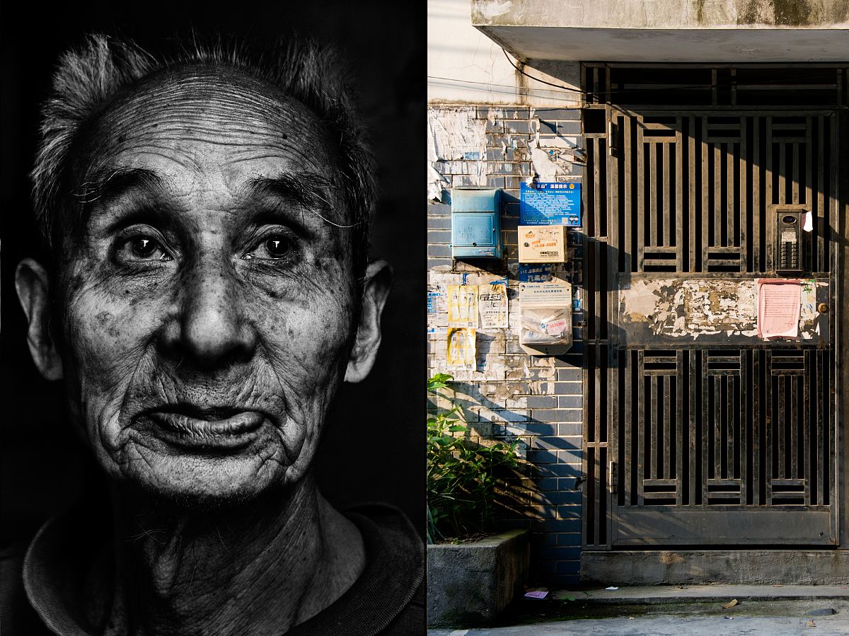 空乘专业报名对身体健康的要求：伤疤真的不能有吗？