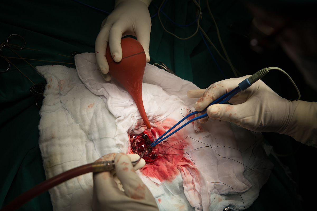 brain surgery.