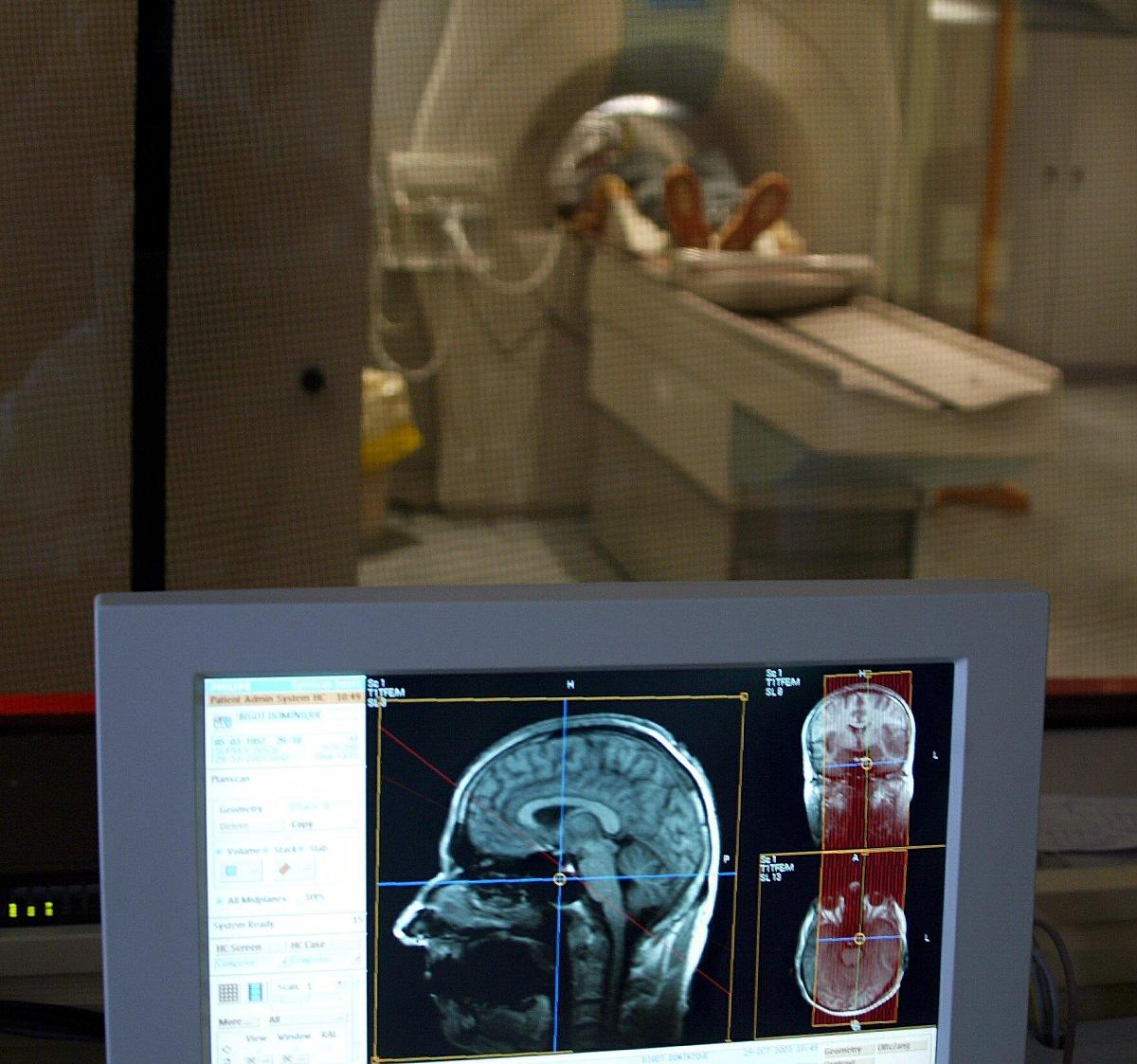 磁共振成像 (MRI) 在多相流测量中的应用：现状及未来趋势