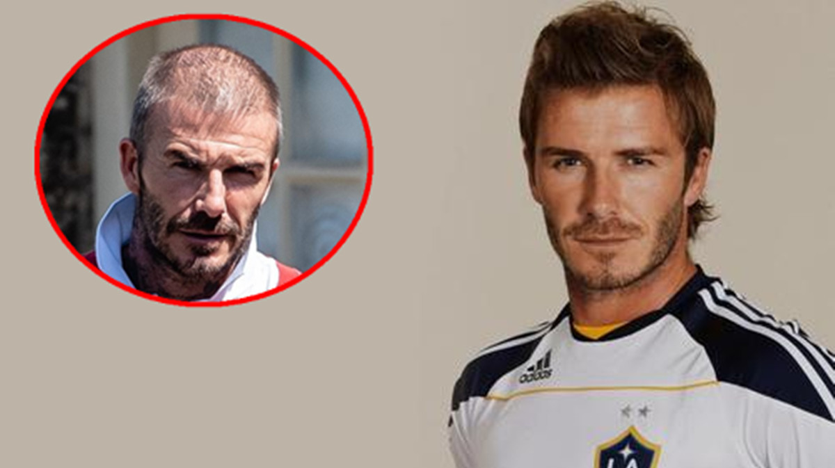 太“秃然”了!贝克汉姆出街购物头发稀疏秃顶明显