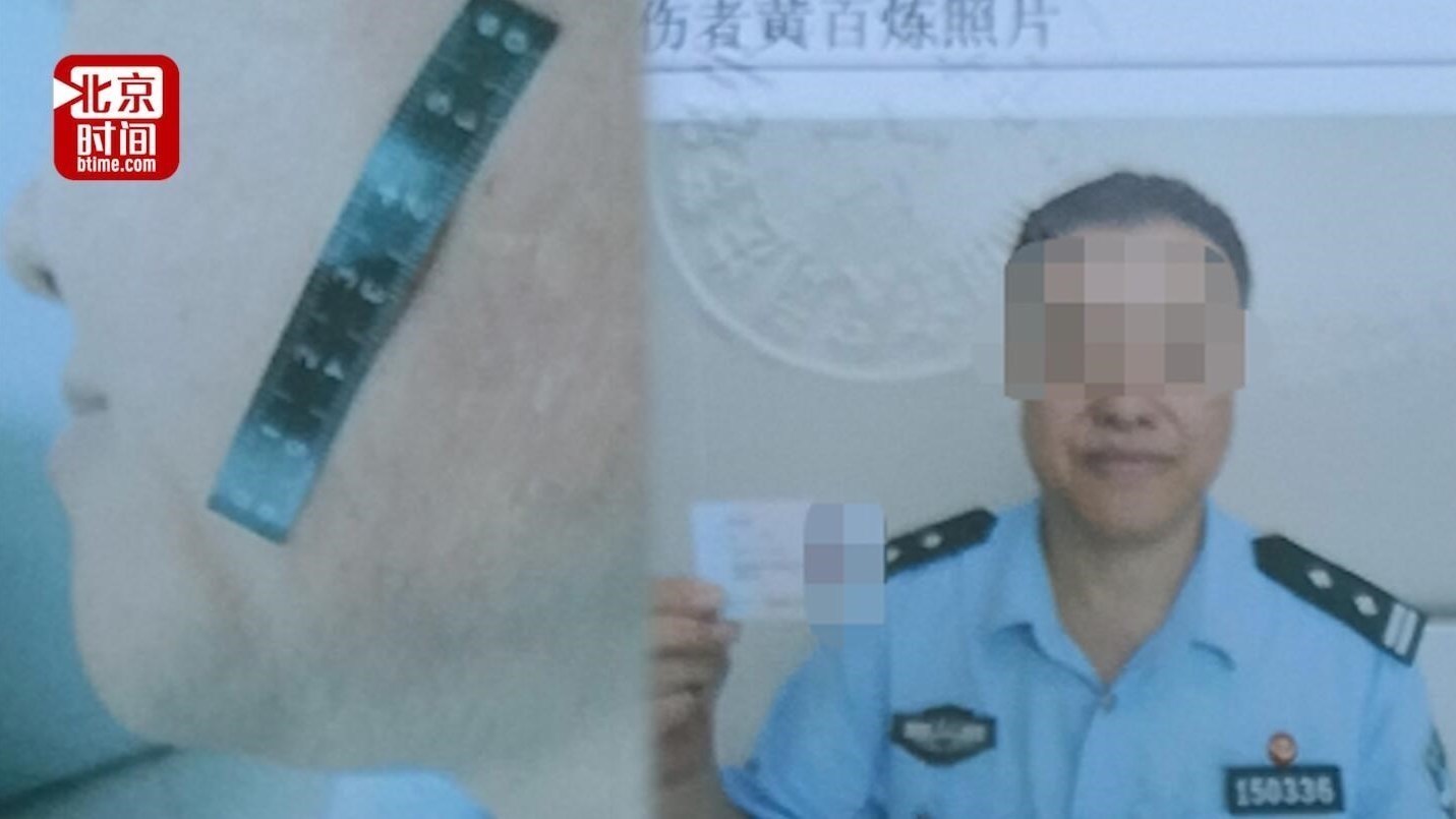 禁毒支队长扇民警耳光 派出所民警现场传唤 其坐椅子上不理会