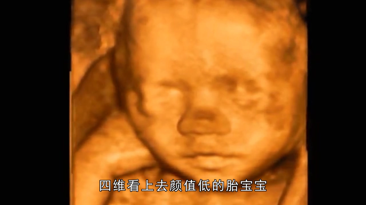 孕期四维彩超看起来丑丑的孩子,是否就“定型”了?看完长见识了