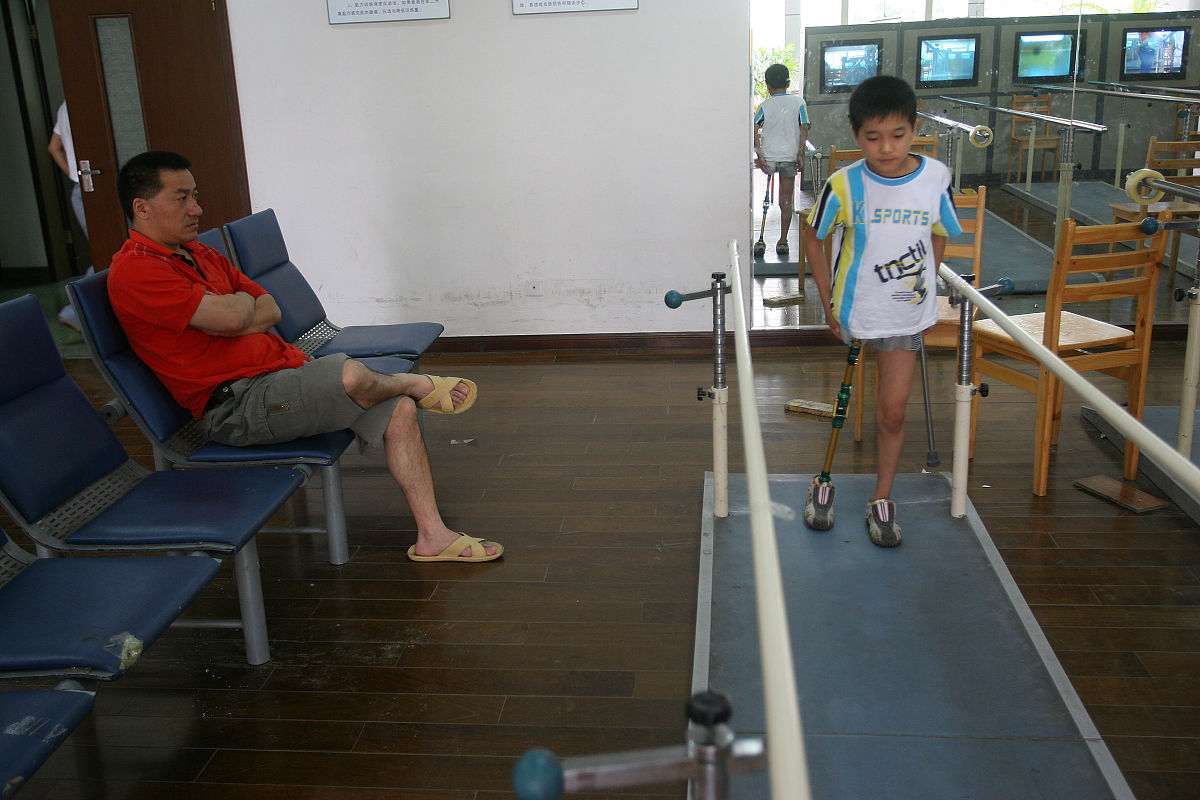 膝盖过伸影响征兵体检吗？