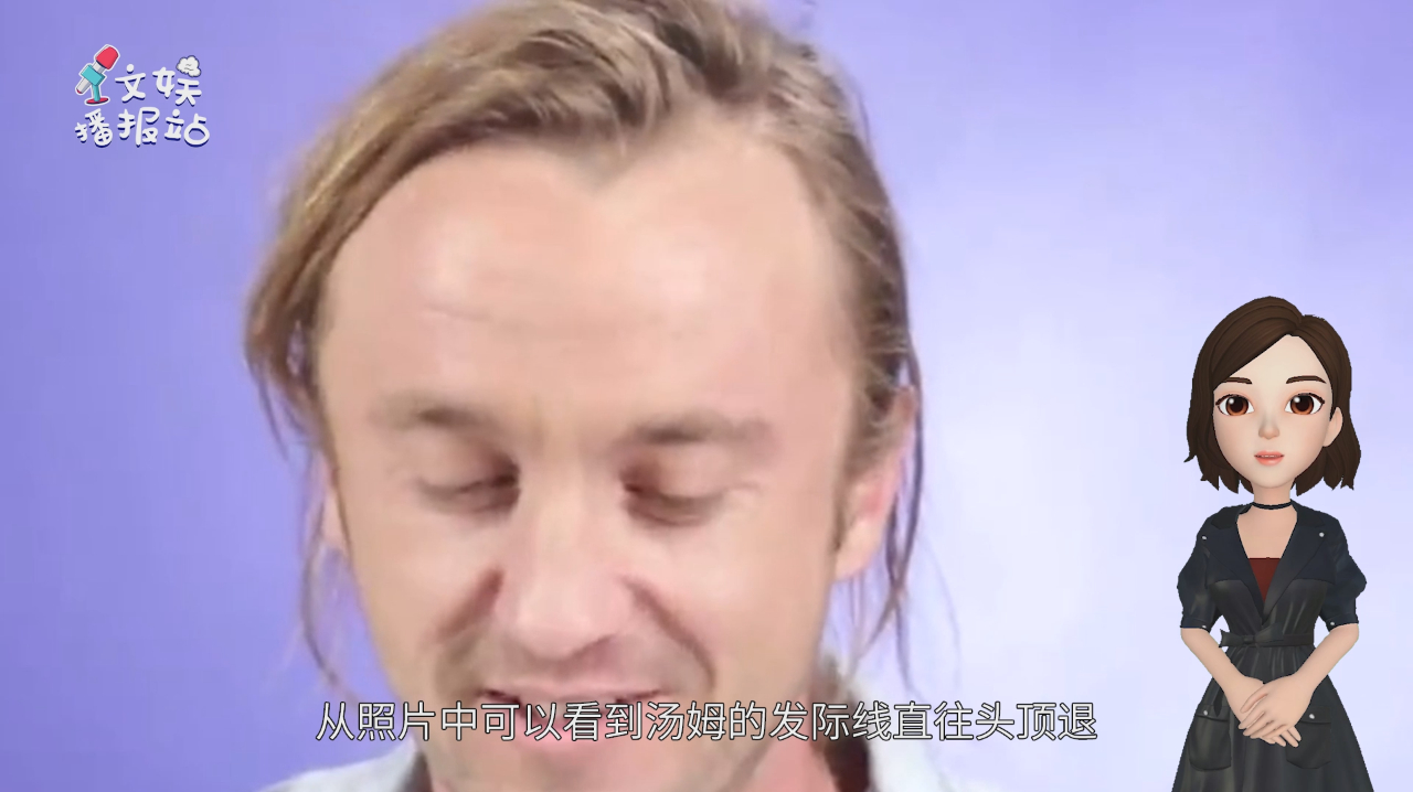 被发际线毁掉的颜王!马尔福赫敏重聚落差太大,岁月真是杀猪刀