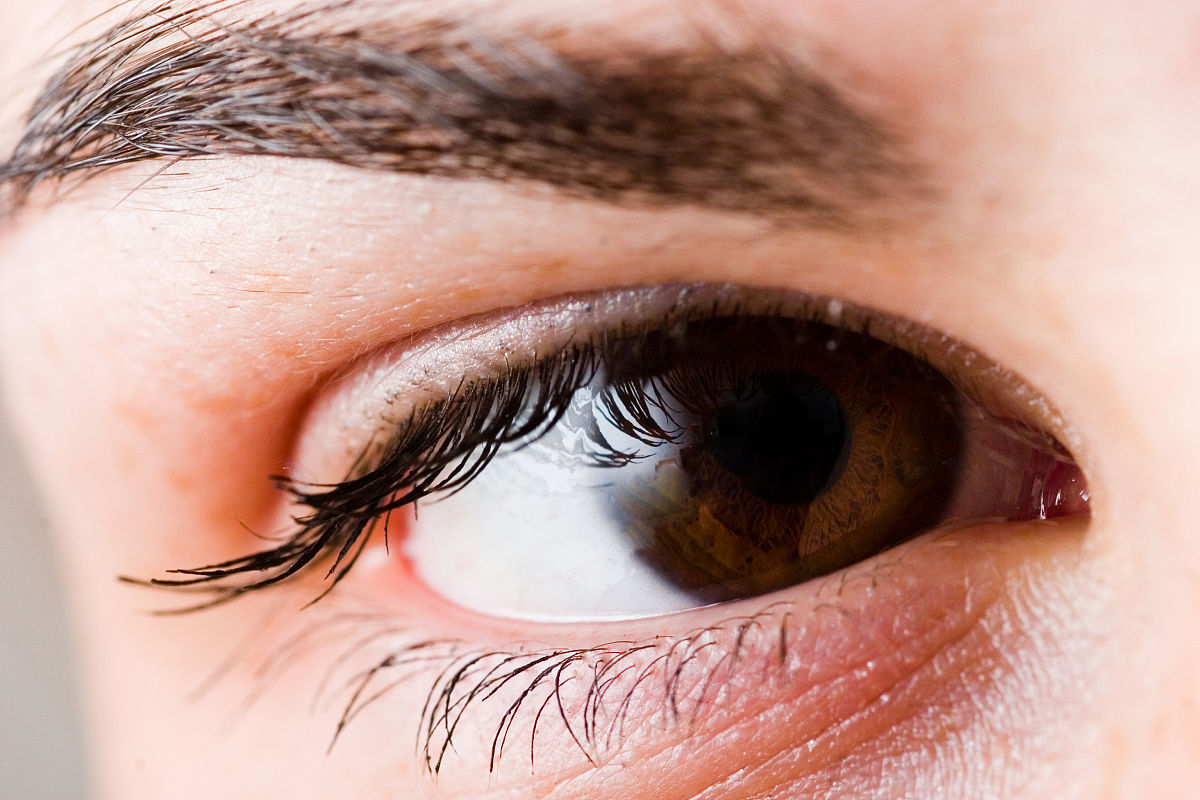 发卡烫睫毛致眼球烫伤：美丽背后的安全警钟