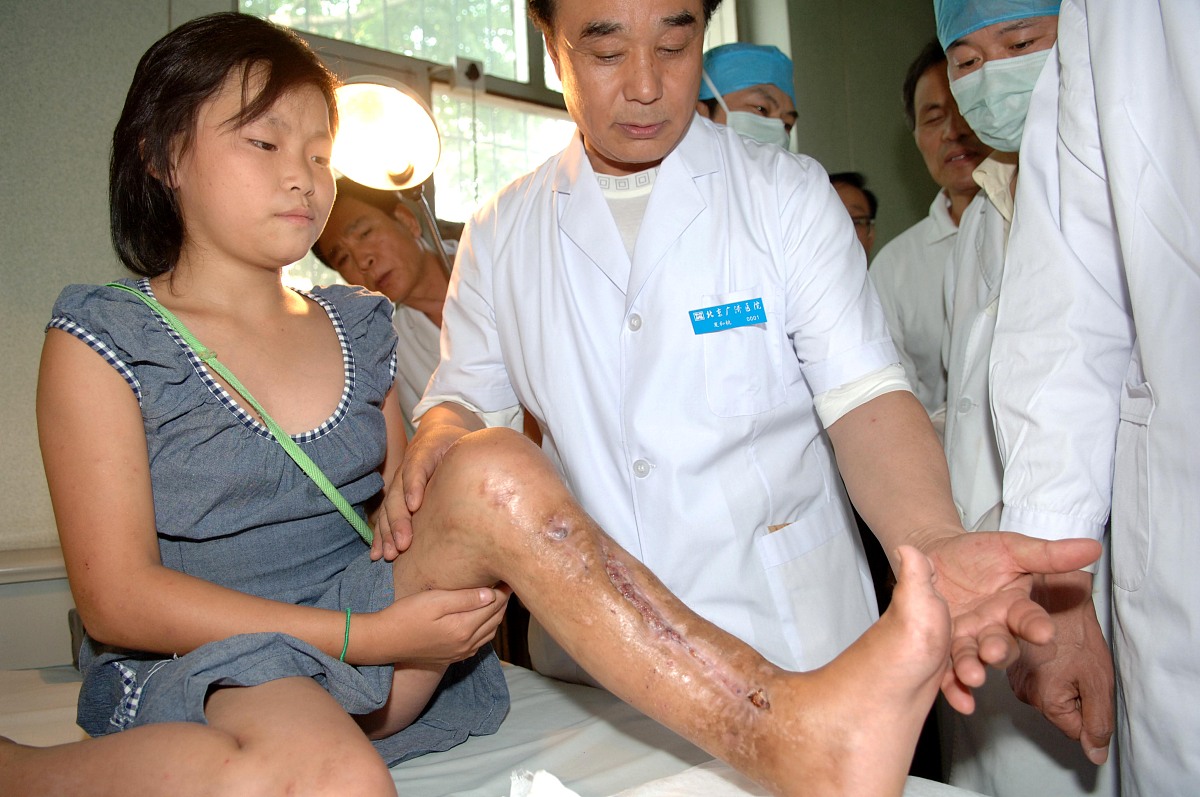 脚臭的话可以用酒精给脚部消毒杀菌吗