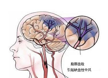 糖尿病友了解“胰岛功能与血糖调控”,量身定制控糖方案