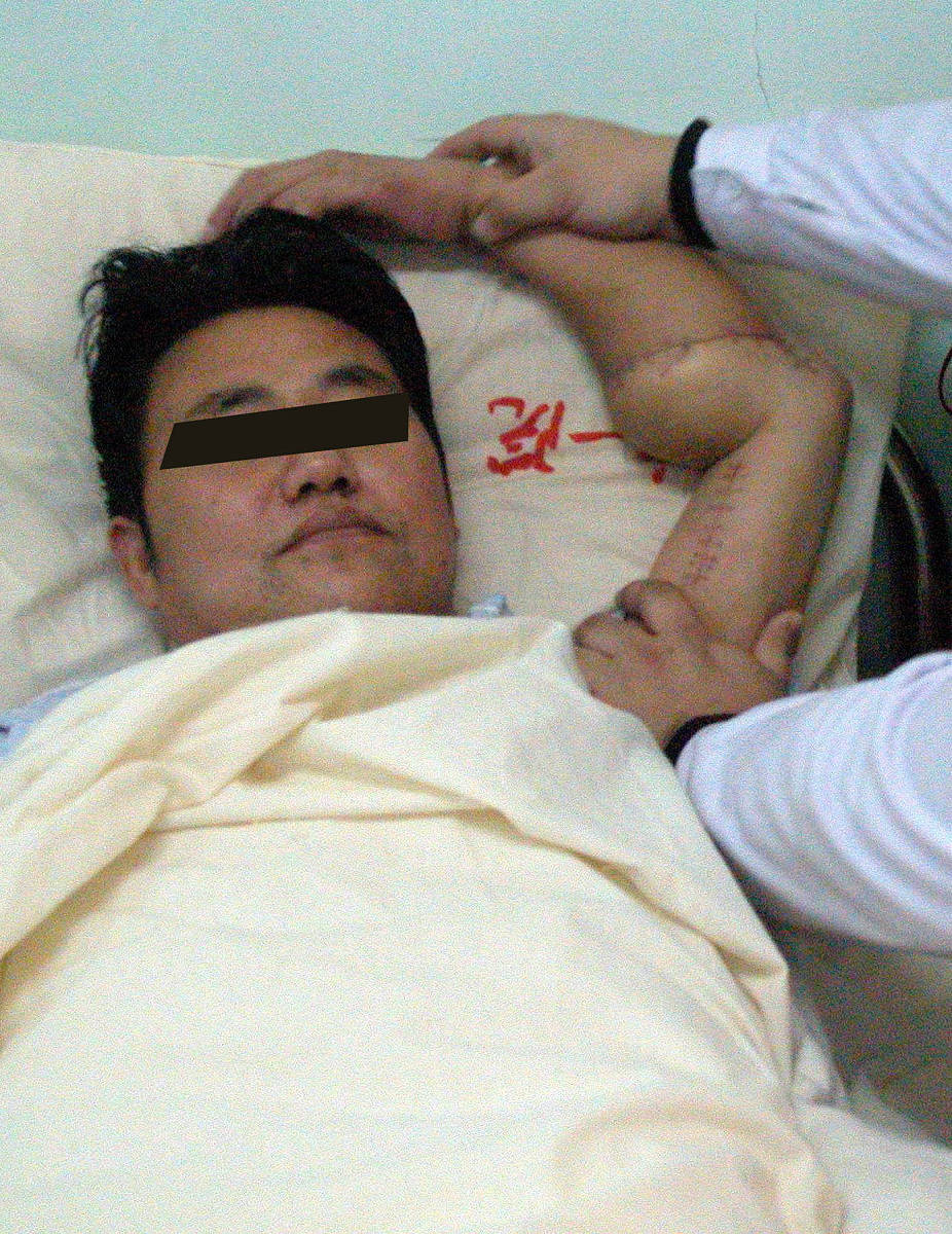 医生正在用按摩的<strong>方法</strong>对陈先生的左臂进行康复治疗.