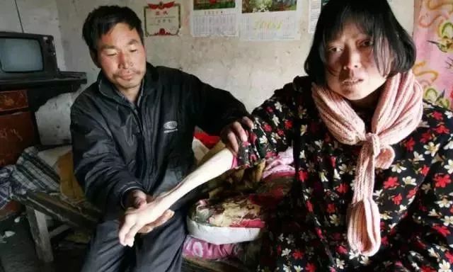 癌症村、毒气、臭水……国外的蓝天白云,是中国人的命给的