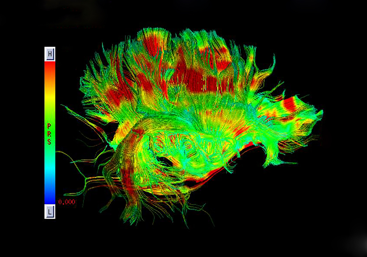 空间分辨率以及光谱分辨率的区别