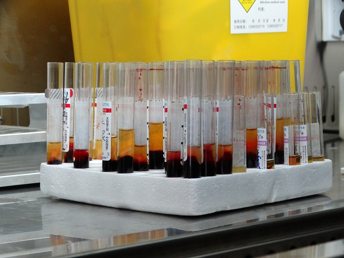 动物细胞与组织损伤实验报告：酒精、高渗盐溶液及培养基的影响