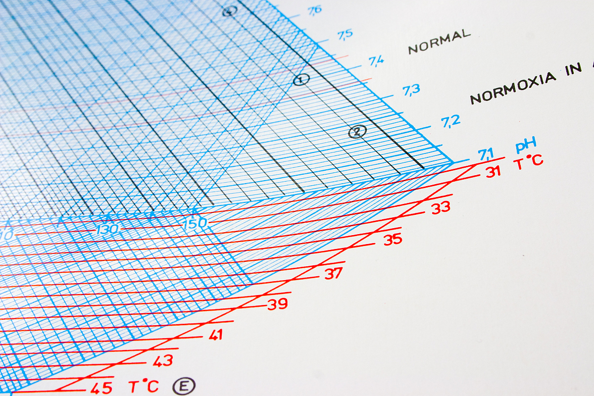 ESPRIT 算法：高精度信号参数估计方法