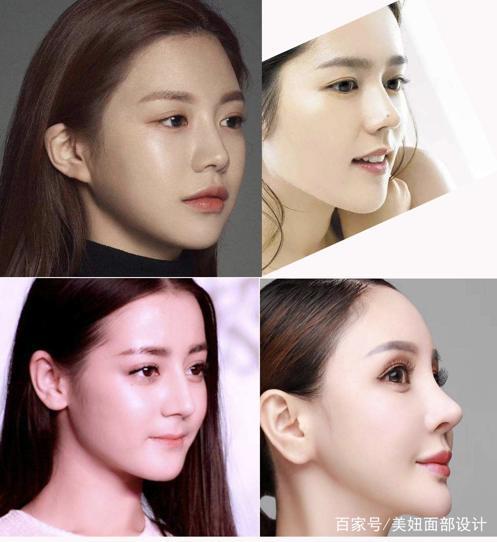 对比网红脸，混血风，最近很火的韩国整容模版高允真的特色在哪里