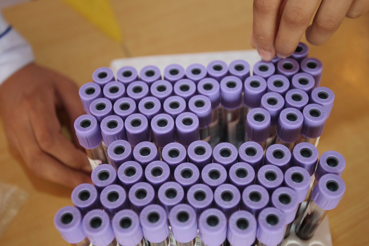 儿童白血病：症状、治疗及预后