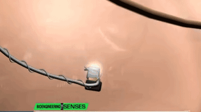 霍金去世，那輛陪伴他50年的黑科技輪椅，永遠失去了主人……