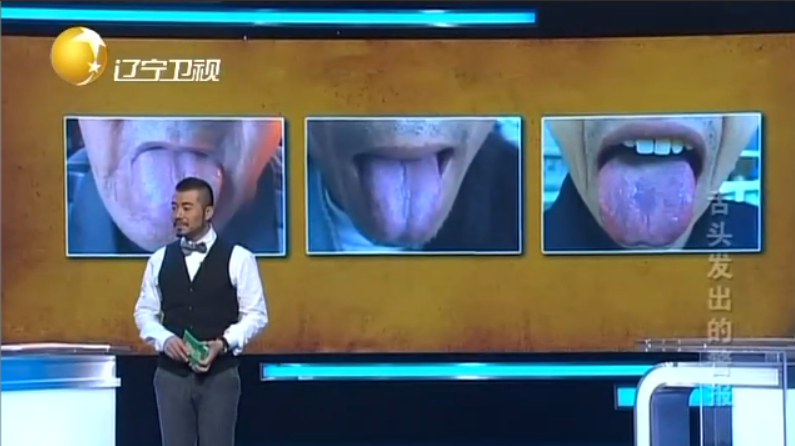健康道:肿瘤患者的舌头长什么样,专家现场讲解,快来看看吧