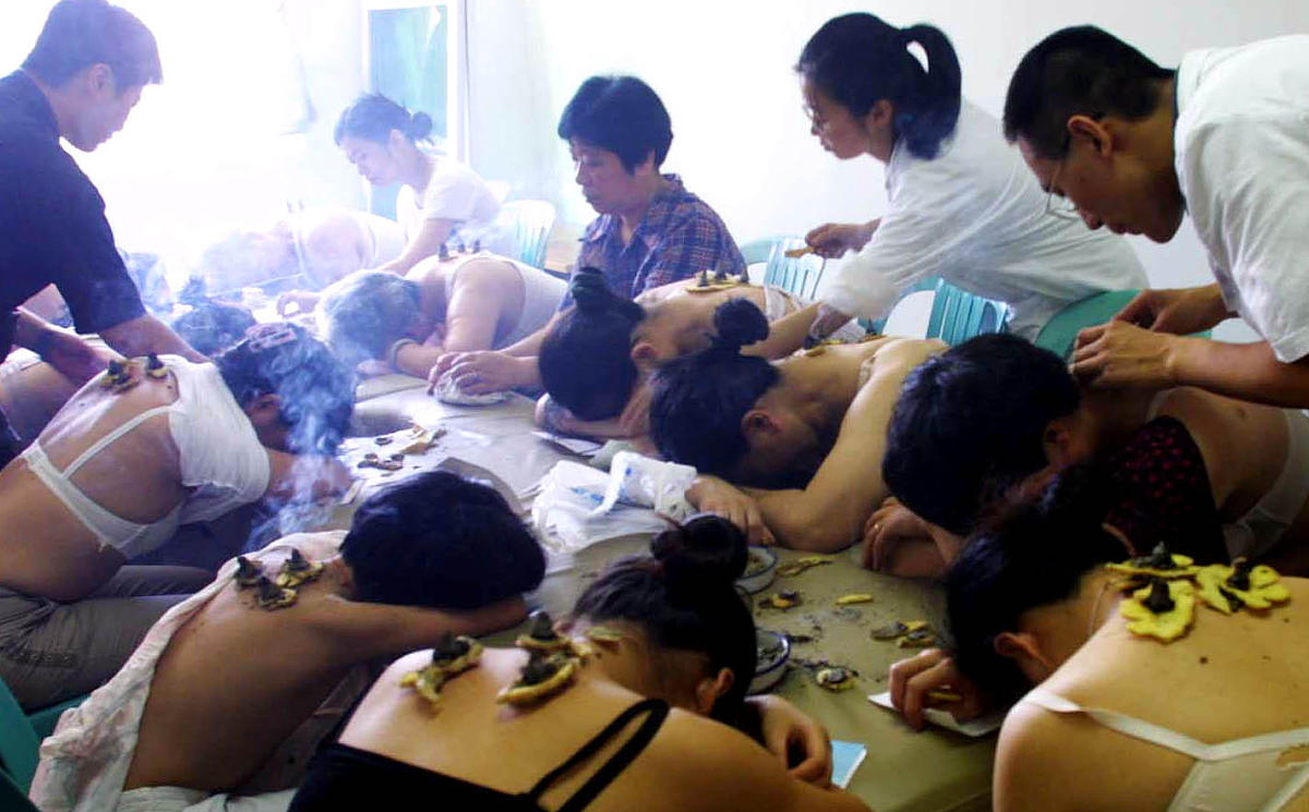 中医外治法：搐鼻疗法详解