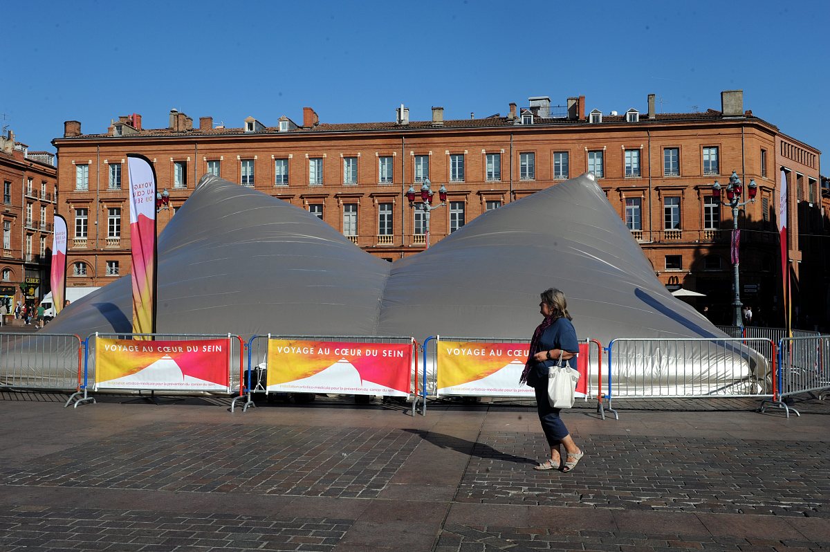 世界最大乳房，木瓜奶形容得了吗？