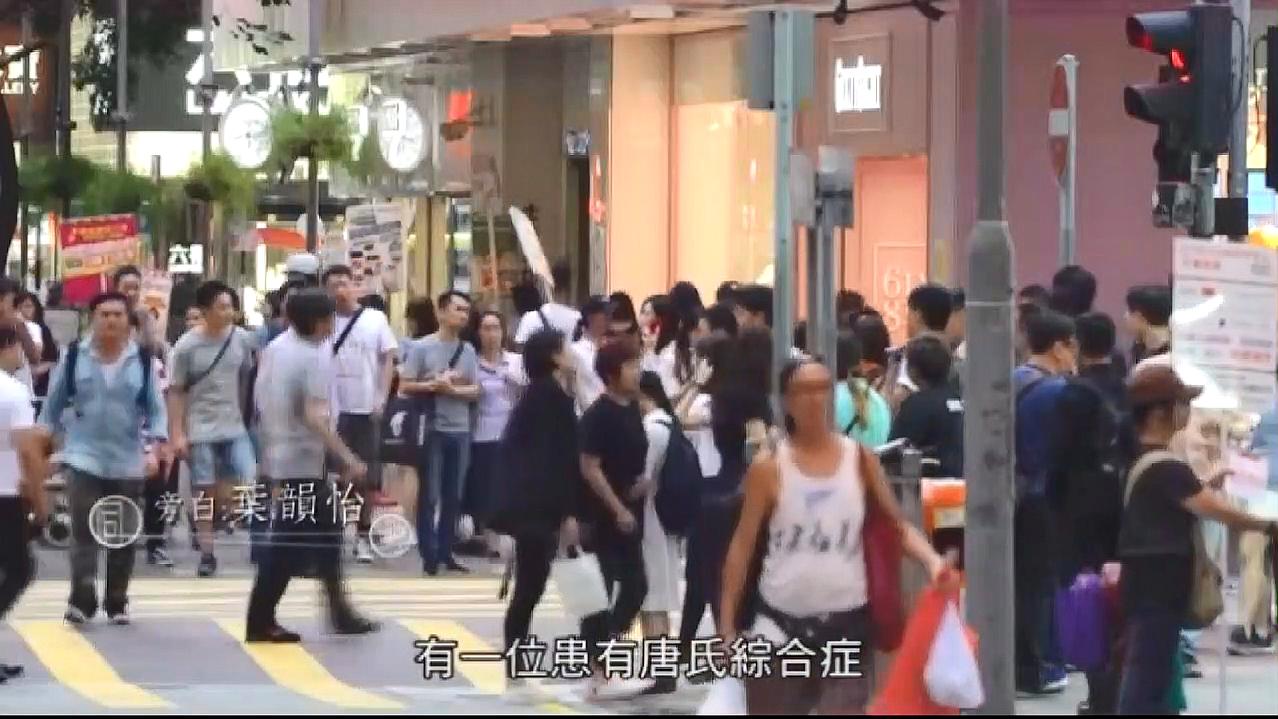 [图]“同理继续走”马浚伟带你深入了解,唐氏综合症患者背后的故事