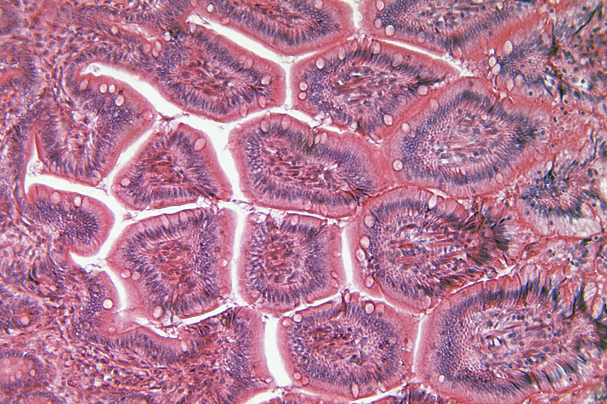 鱼鳃和肾脏组织病理学改变：核退变和核内包涵体