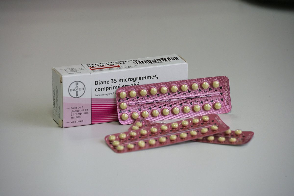 痤疮治疗方法：外用药、口服药、生活习惯改变