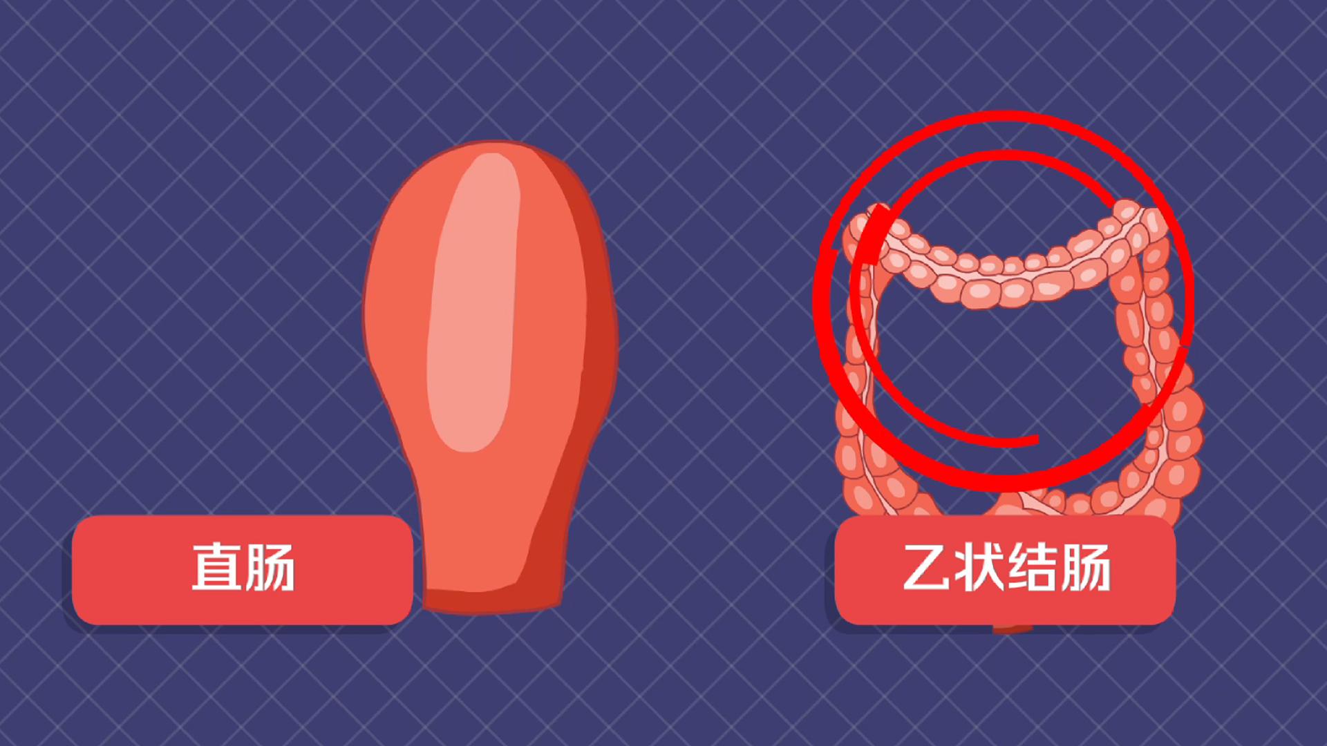 一分钟了解直肠