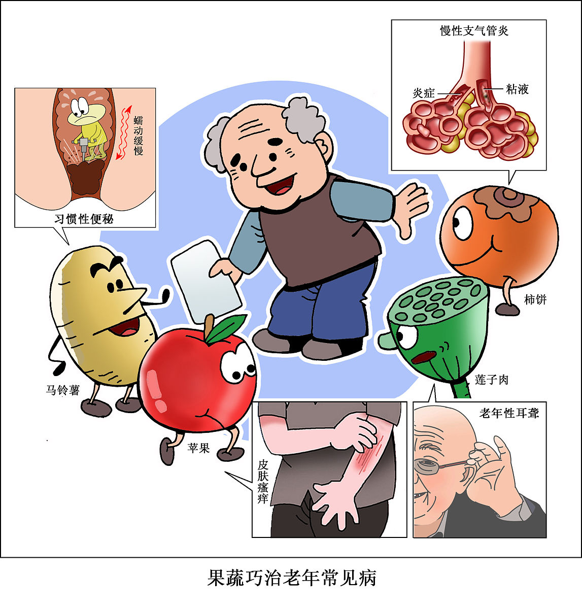 血脂异常造成脑血管意外的6000字科普文章
