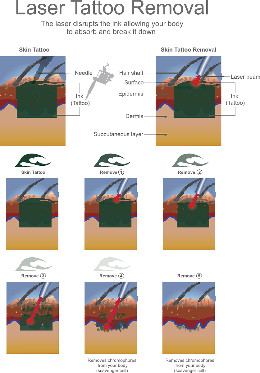 润色并通顺下面这这段话尽可能保证不添加或删减：。但由于TmYAG的准三能级结构性质12这些激光器需要在较低的冷却温度下实现高功率激光输出晶体端面容易结露会对光学膜层造成损伤13而且这些装置结构复杂、体积庞大这些问题限制了其在相关领域的应用。