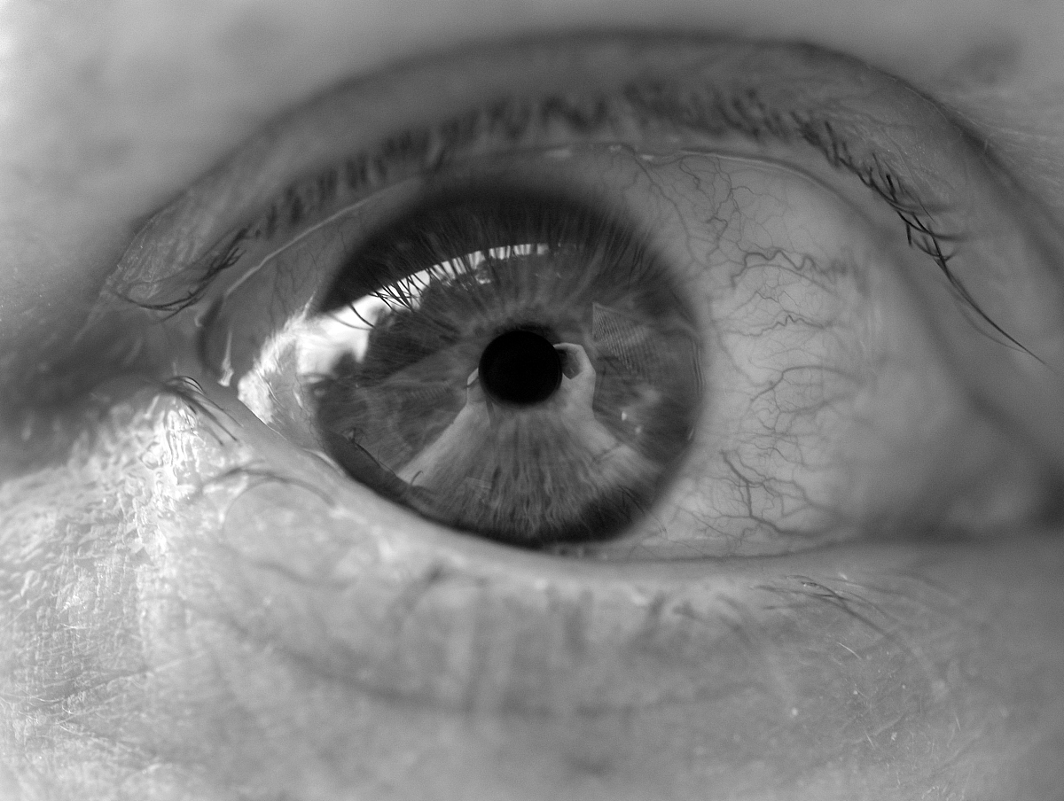 能否介绍下关于眼睛疾病 先天性无虹膜