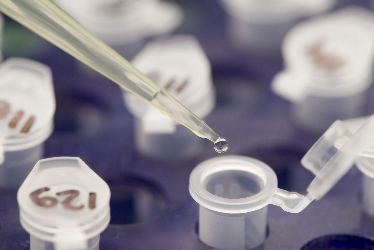 人工授精的费用