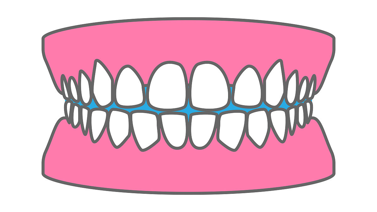 teeth(teeth怎么读)