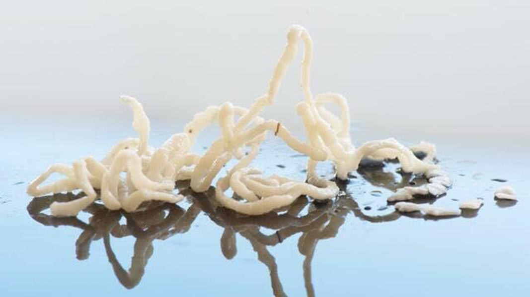 寄生虫最多的7类食物,再喜欢也要戒口,最后3个几乎人人都爱吃