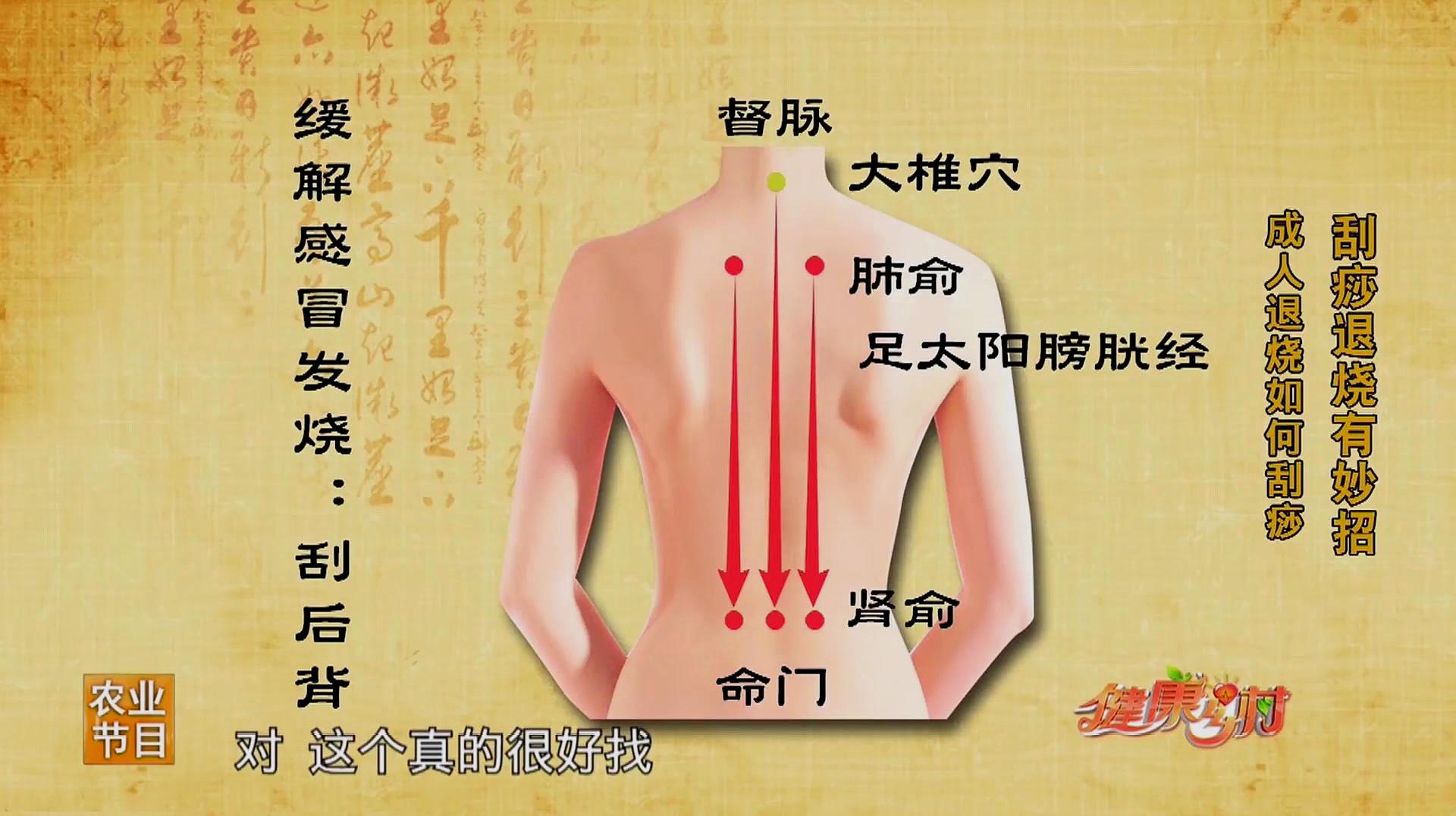 [图]成人刮痧可以退烧？看看这几个地方，还有具体操作方法