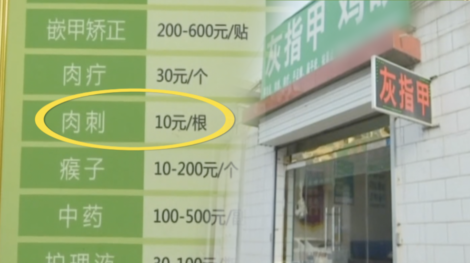 10元1根肉刺拔出4660根?女子修脚店拔肉刺竟花46600