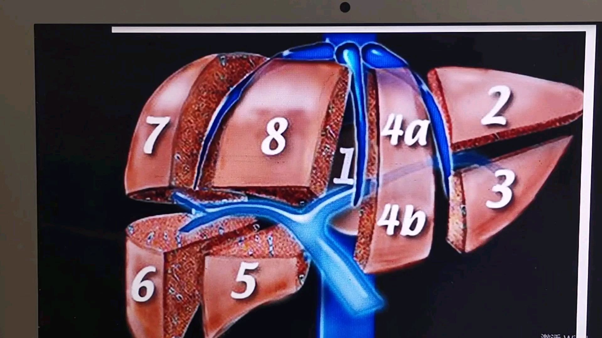 肝脏分叶分段你了解吗?简单从模拟图及实例上了解肝脏分叶分段!